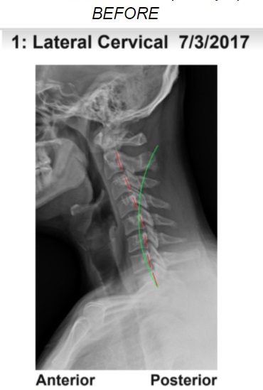 Spine