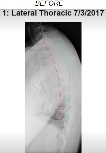 Spine