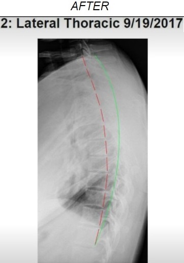 Spine
