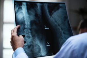Xray - Spine Adjustment