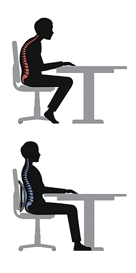 bad posture example
