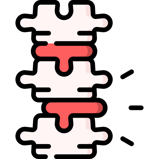 spine spine surgery alternative