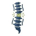 weakened spinal ligaments - steroid injection