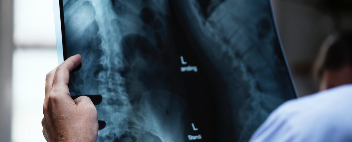 Xray - Spine Adjustment